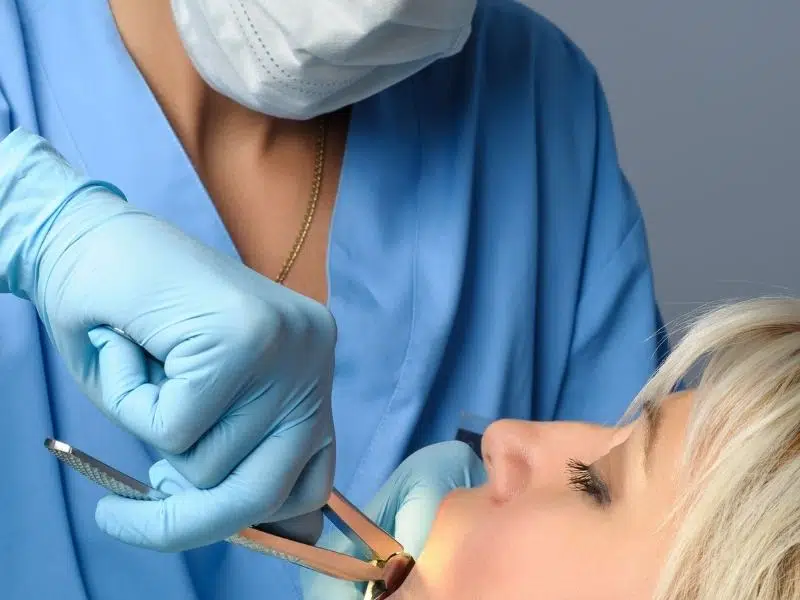 walk in tooth extraction